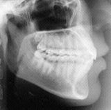 Radiologia Odontológica em Magé